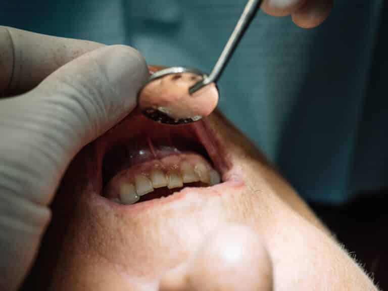 a patient learning how to cure gum disease without a dentist