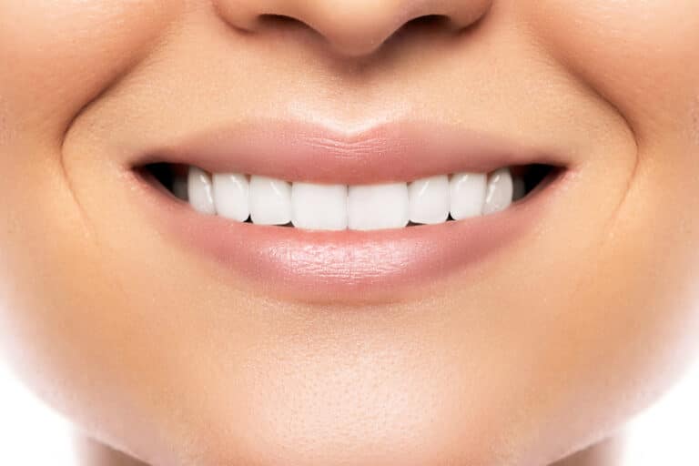 Closeup of beautiful female smile with veneers